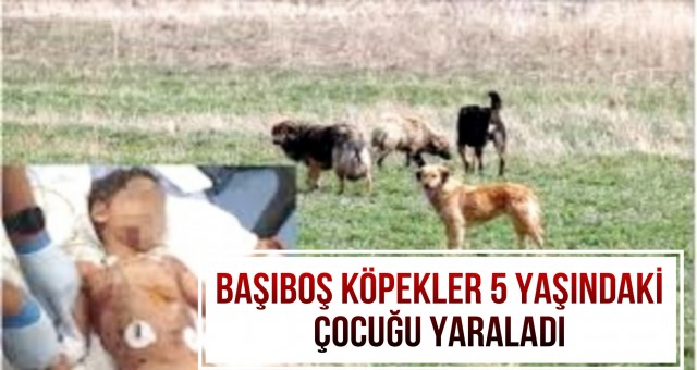 Adana'da Başıboş Köpekler 5 Yaşındaki Çocuğu Yaraladı.